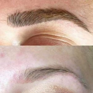 Before and right after eyebrow tattoo removal  Her microbladed tail  was higher than her natural brow and she wants her eyebrows redone   Instagram